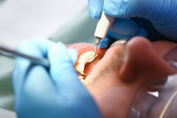 Best Knocked-Out Tooth Emergency  in Gilbertsville, PA