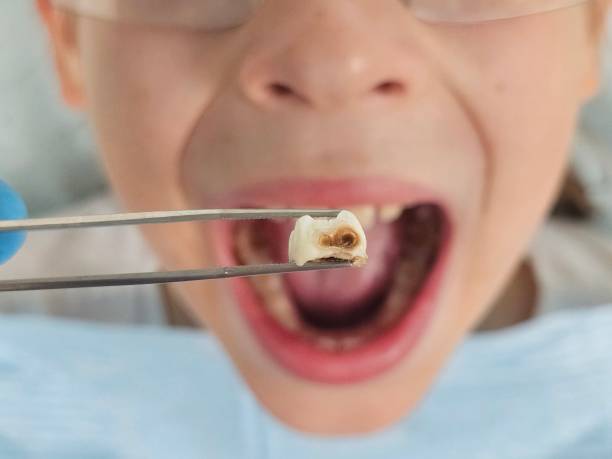 Best Tooth Pain Emergency Relief  in Gilbertsville, PA